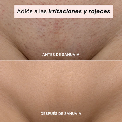 Depiladora 2 en 1 | Olvídate del dolor y la irritación al depilar